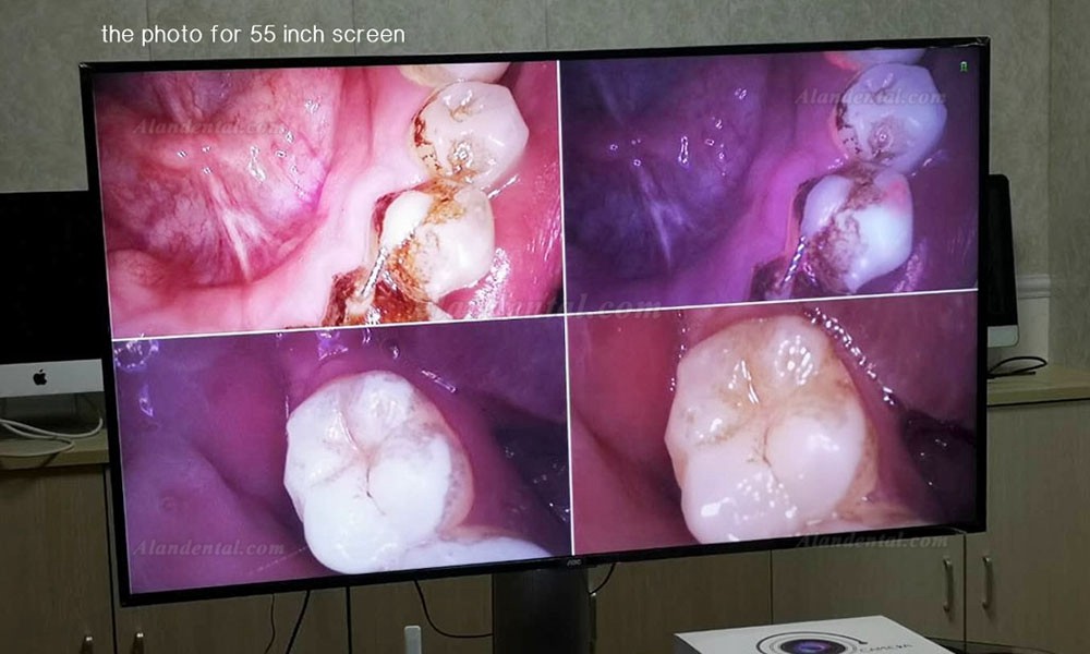 Magenta MD4000 Dental Intraoral Camera 1/4" CMOS VGA & HDMI