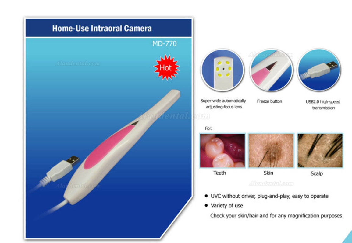 2017 New Magenta® MD770 1.3 Mega Pixels Mini USB Intraoral Oral Camera