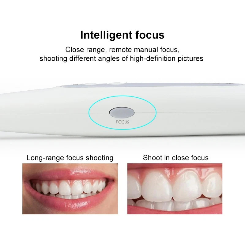 MLG CF686B Dental 4K HD USB Intraoral Camera 1/2.8-inch sensor