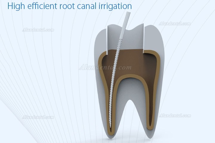 Refine MaxPiezo7/DS7 Ultrasonic Scaler Root Canal irrigation Scaler Compatible EMS/SATELEC