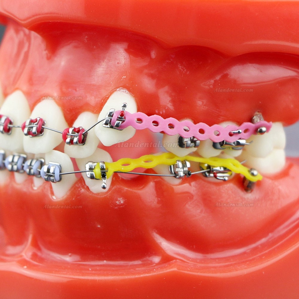 thumbnail image 2 of Dental Typodont Study Model With Brackets, Arch Wire, And Buccal Tube – Orthodontic Training Tool DM-4 2 of 3