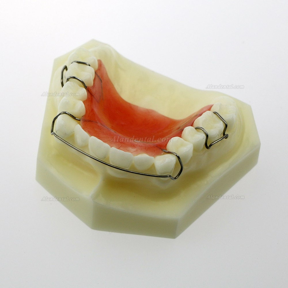 Dental Model #3007 01 - Hawley Retainer Model