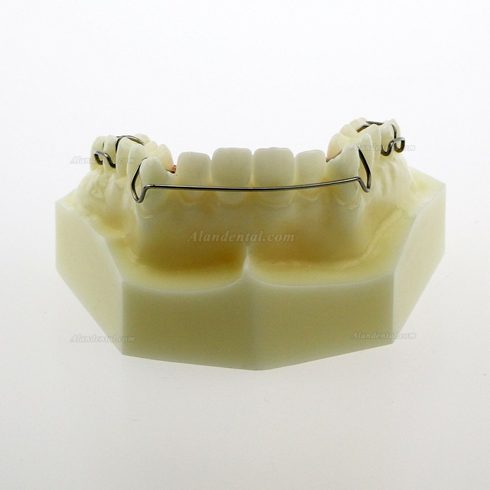 Dental Model #3007 01 - Hawley Retainer Model