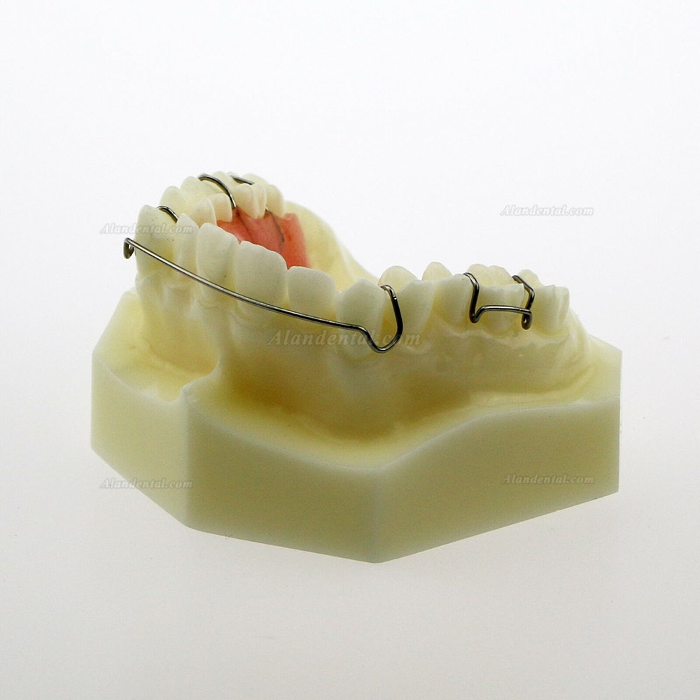 Dental Model #3007 01 - Hawley Retainer Model