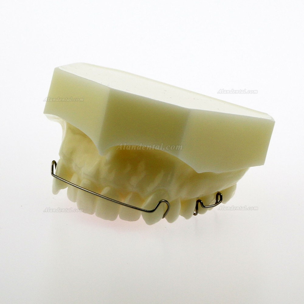 Dental Model #3007 01 - Hawley Retainer Model