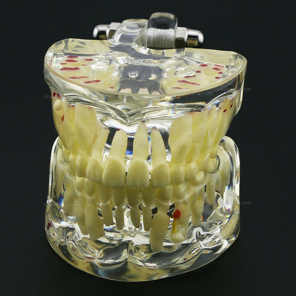 Dental Children Teeth Model Pediatric Pathology Demonstration Study Model 4002