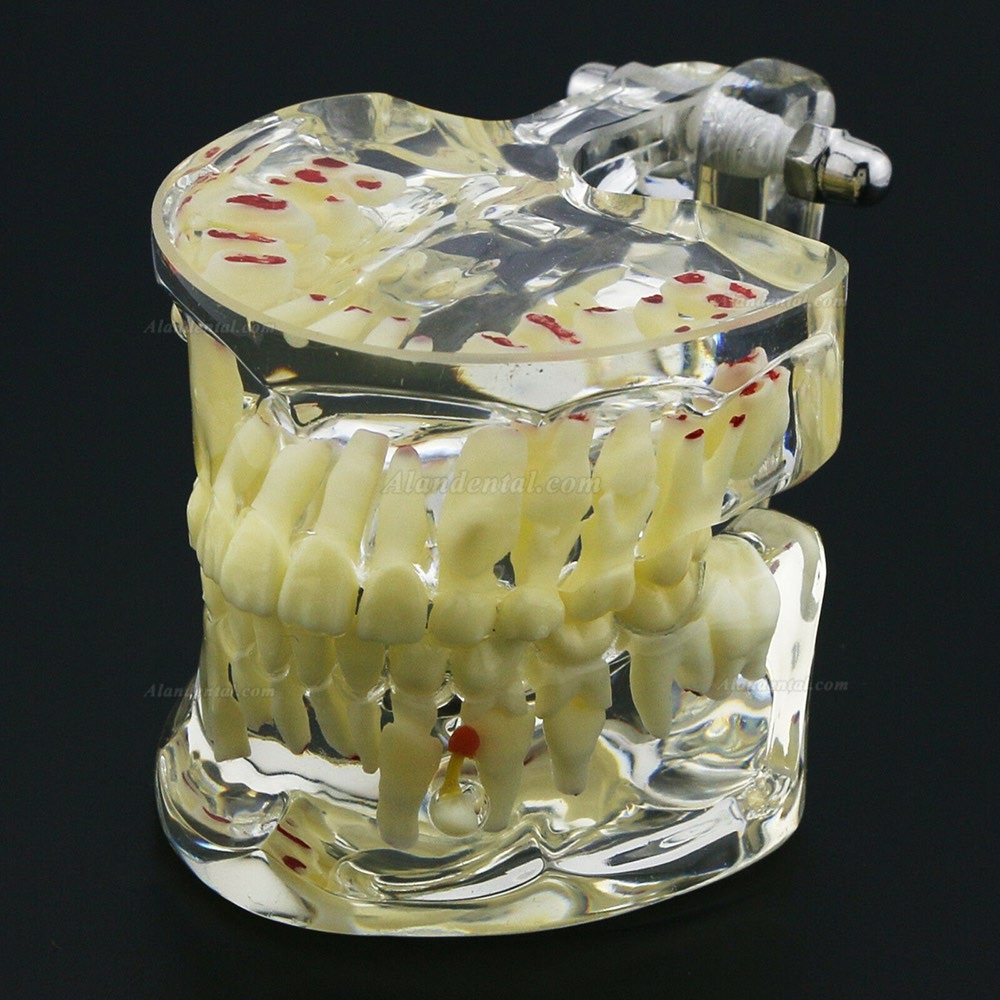 Dental Children Teeth Model Pediatric Pathology Demonstration Study Model 4002