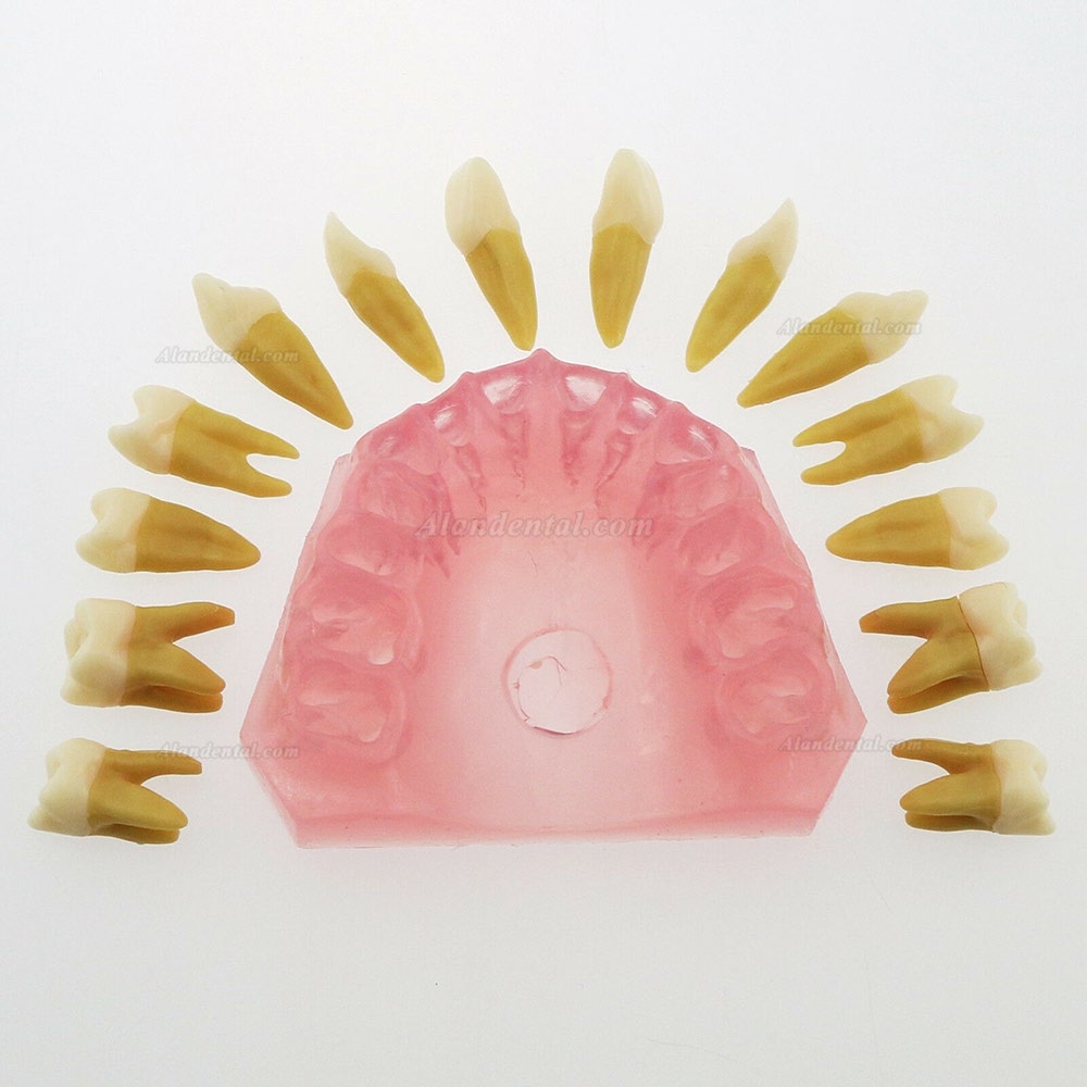 1 Pcs Dental Teeth Model With 28 Pcs Removable Teeth Study Teach Standard Model 4004