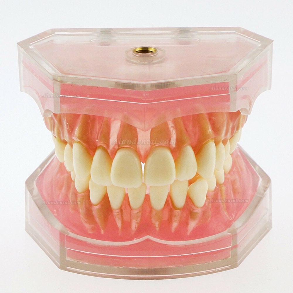 1 Pcs Dental Teeth Model With 28 Pcs Removable Teeth Study Teach Standard Model 4004