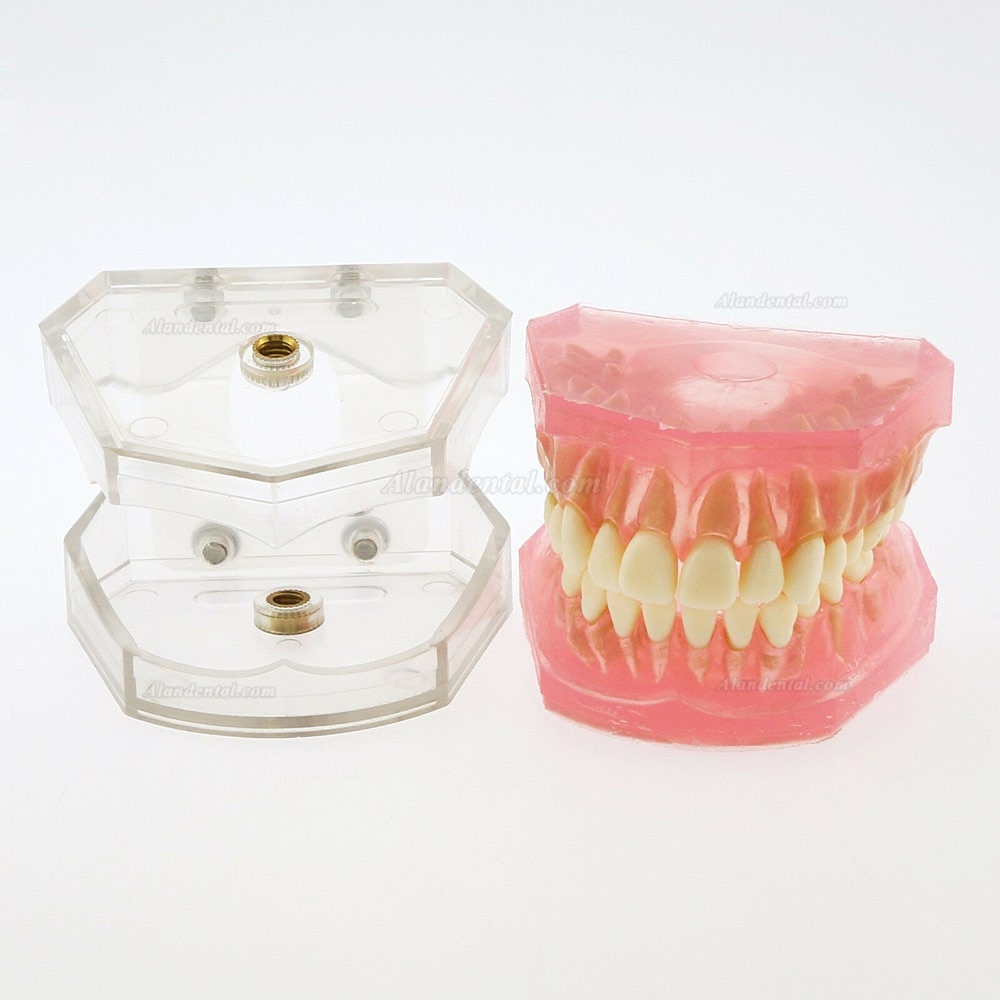 1 Pcs Dental Teeth Model With 28 Pcs Removable Teeth Study Teach Standard Model 4004