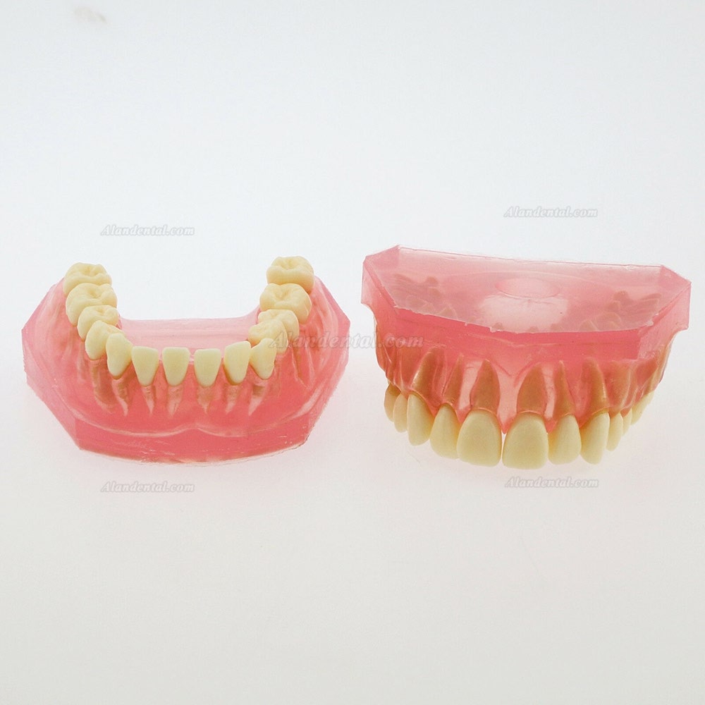 1 Pcs Dental Teeth Model With 28 Pcs Removable Teeth Study Teach Standard Model 4004