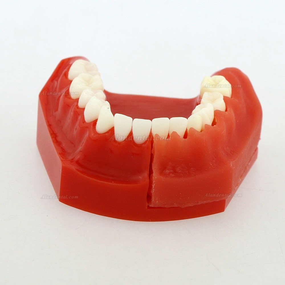Dental Teeth Permanent Tooth Alternate Demonstration Study Teach Model 4006#