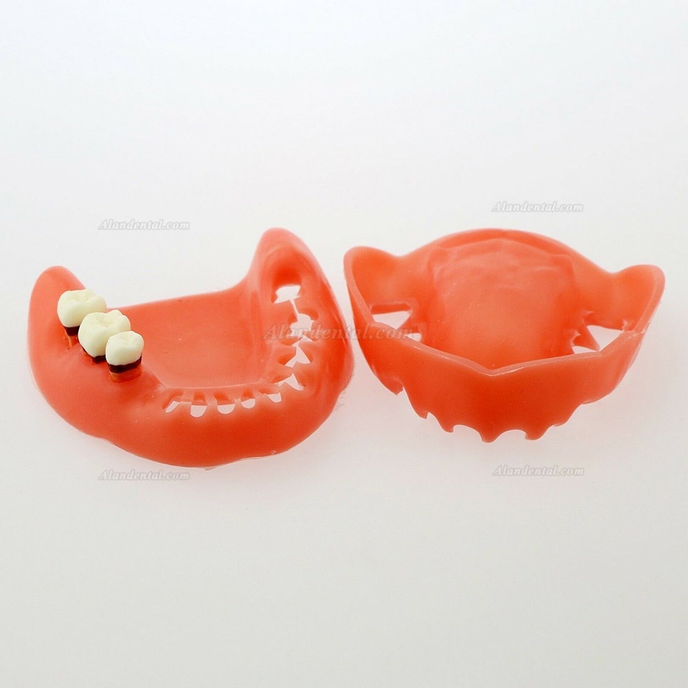 Dental Model Adult Pathological Periodontal Disease Study Teeth Model 4017