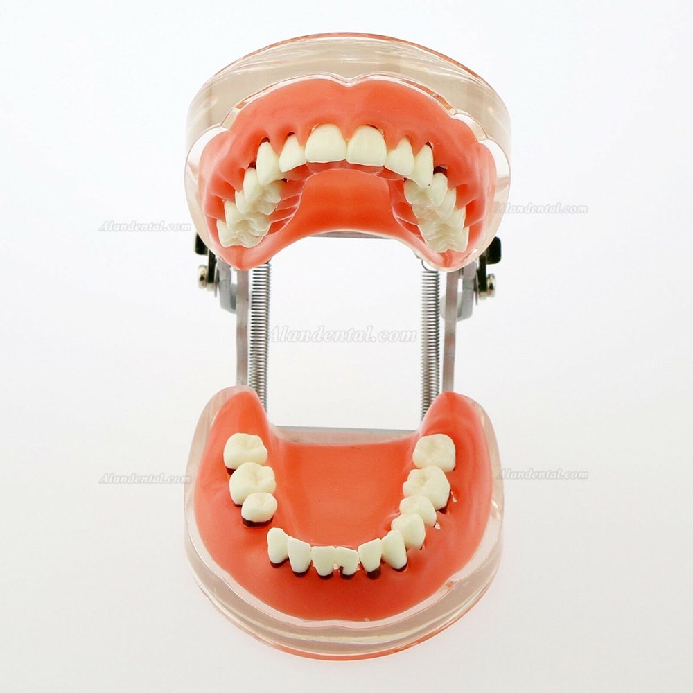 Dental Model Adult Pathological Periodontal Disease Study Teeth Model 4017