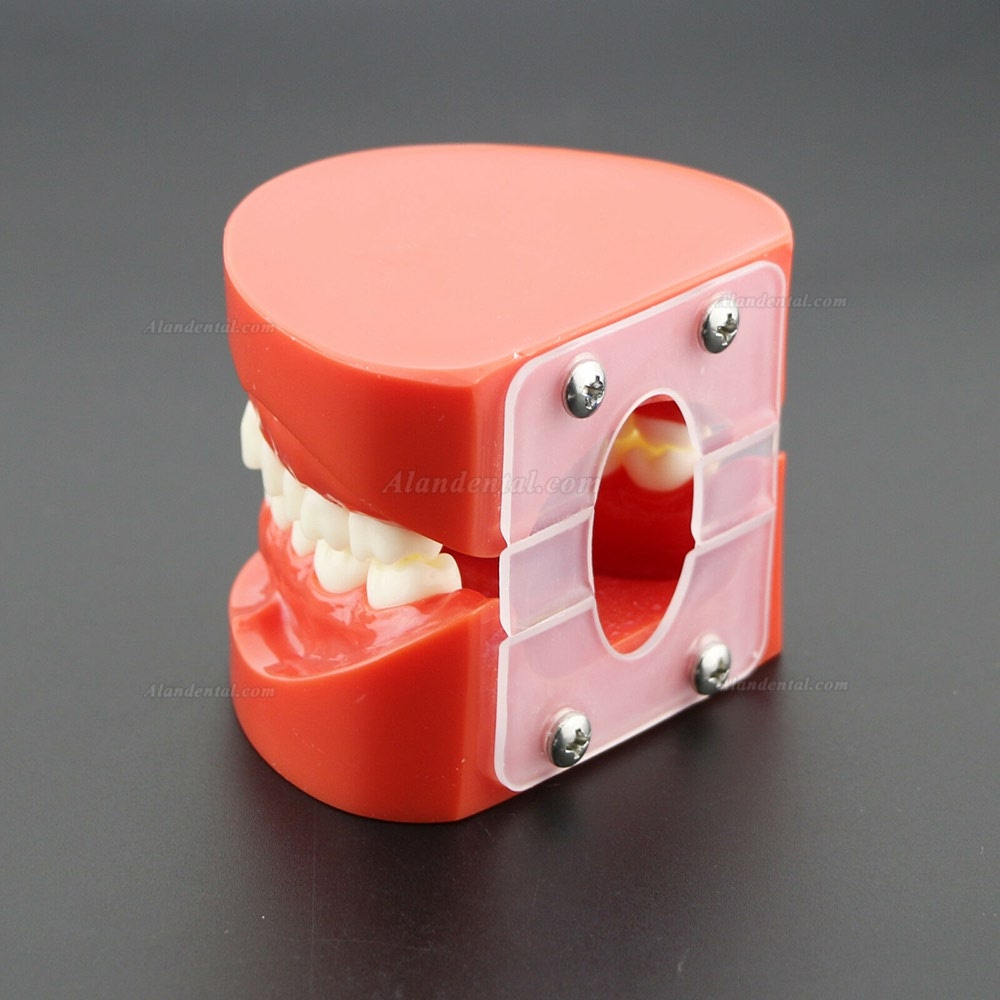 Dental Teach Study Adult Standard Typodont Demonstration Teeth Model 7004 Red