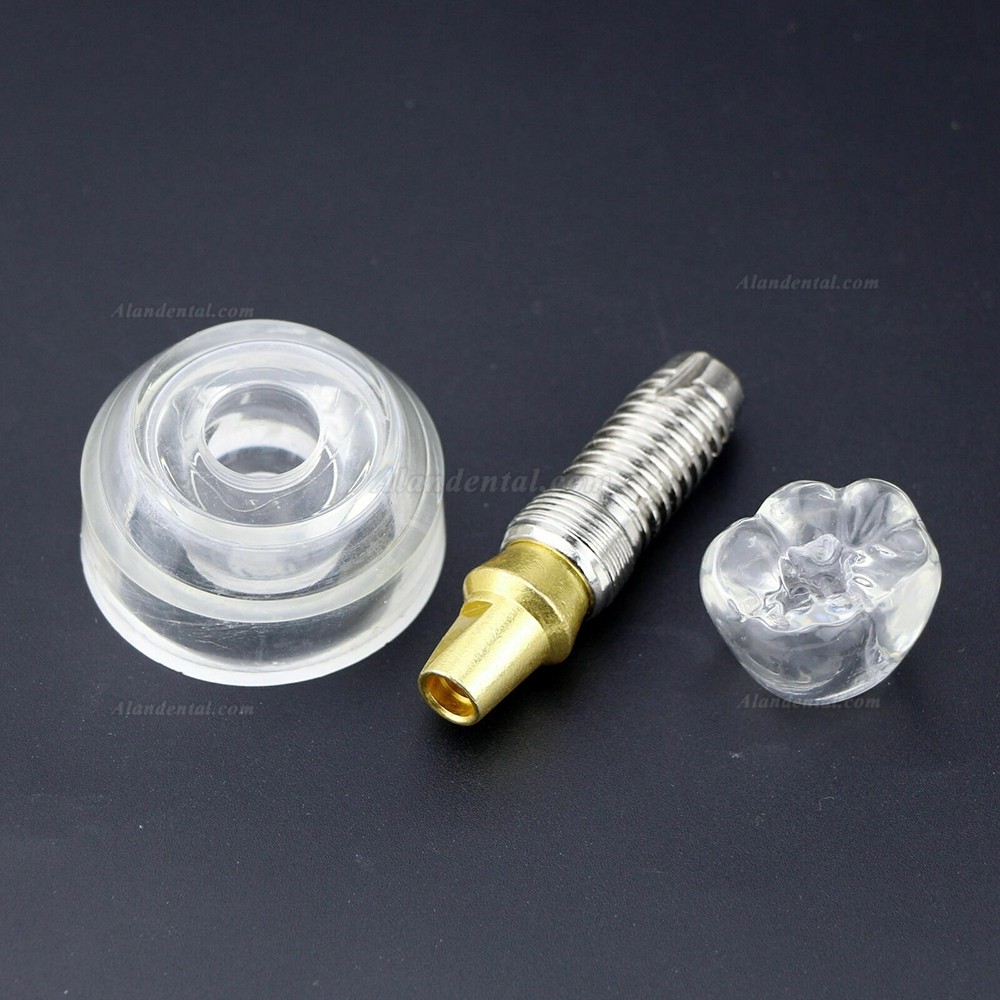 Dental Implant Demonstration Model 2.5x Size Detachable Transparent