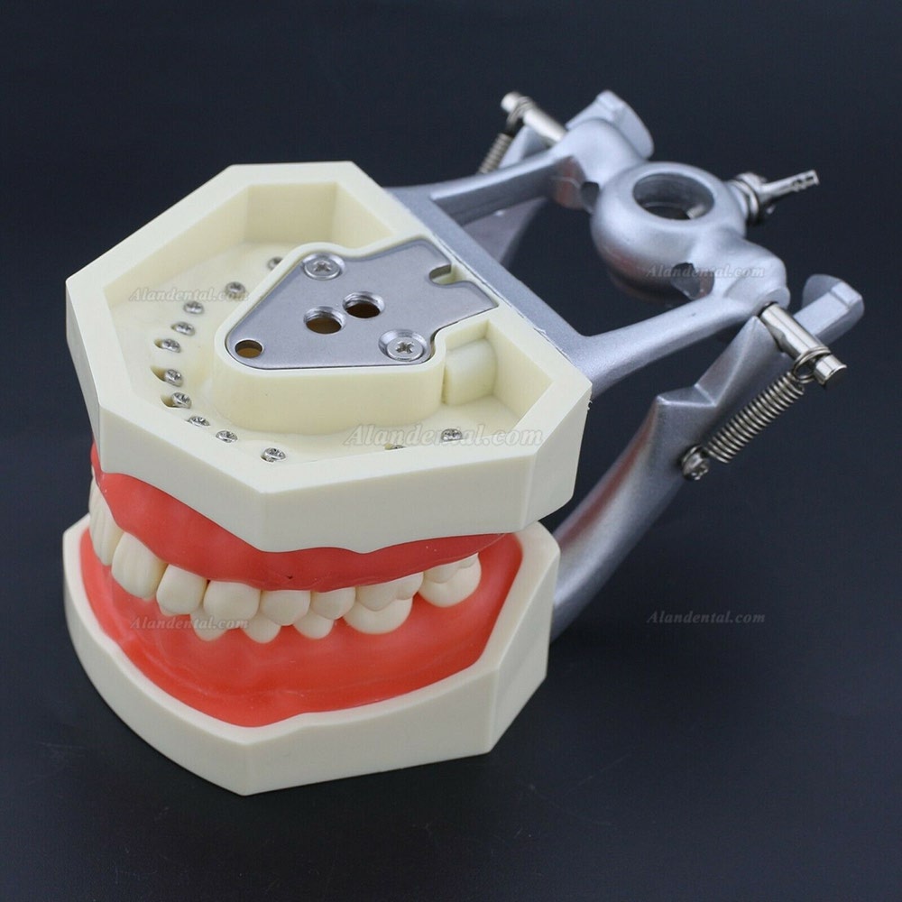 Kilgore NISSIN Style Dental Typodont Model with 28pcs Removable Teeth M8011