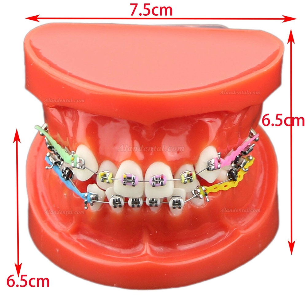 Dental Orthodontic Teeth Model + Metal Ceramic Bracket Tube Self-ligating Chain