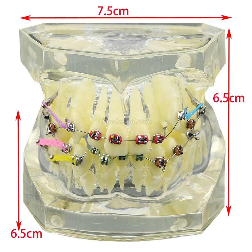 Dental Orthodontic Teeth Model + Metal Ceramic Bracket Tube Self-ligating Chain