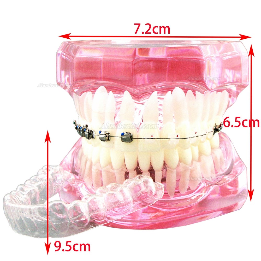 Dental Orthodontic Teeth Model + Metal Ceramic Bracket Tube Self-ligating Chain