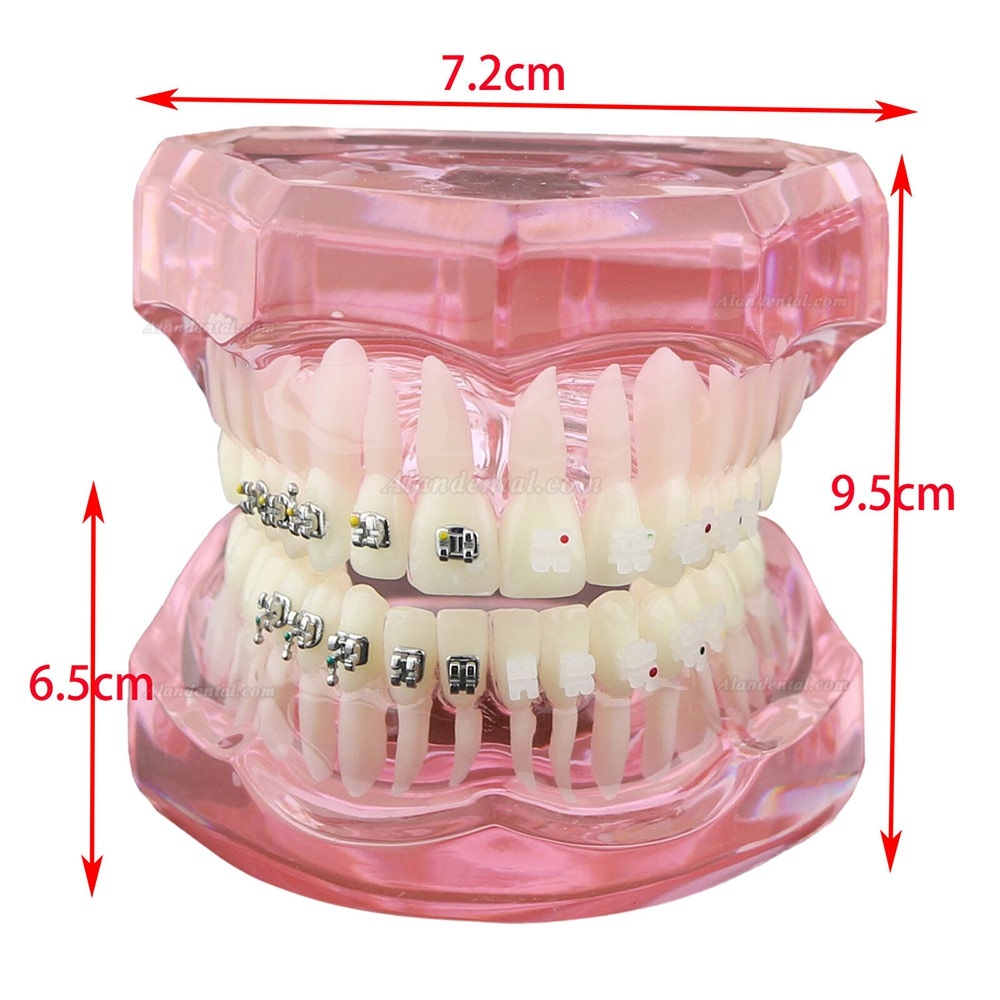 Dental Orthodontic Teeth Model + Metal Ceramic Bracket Tube Self-ligating Chain