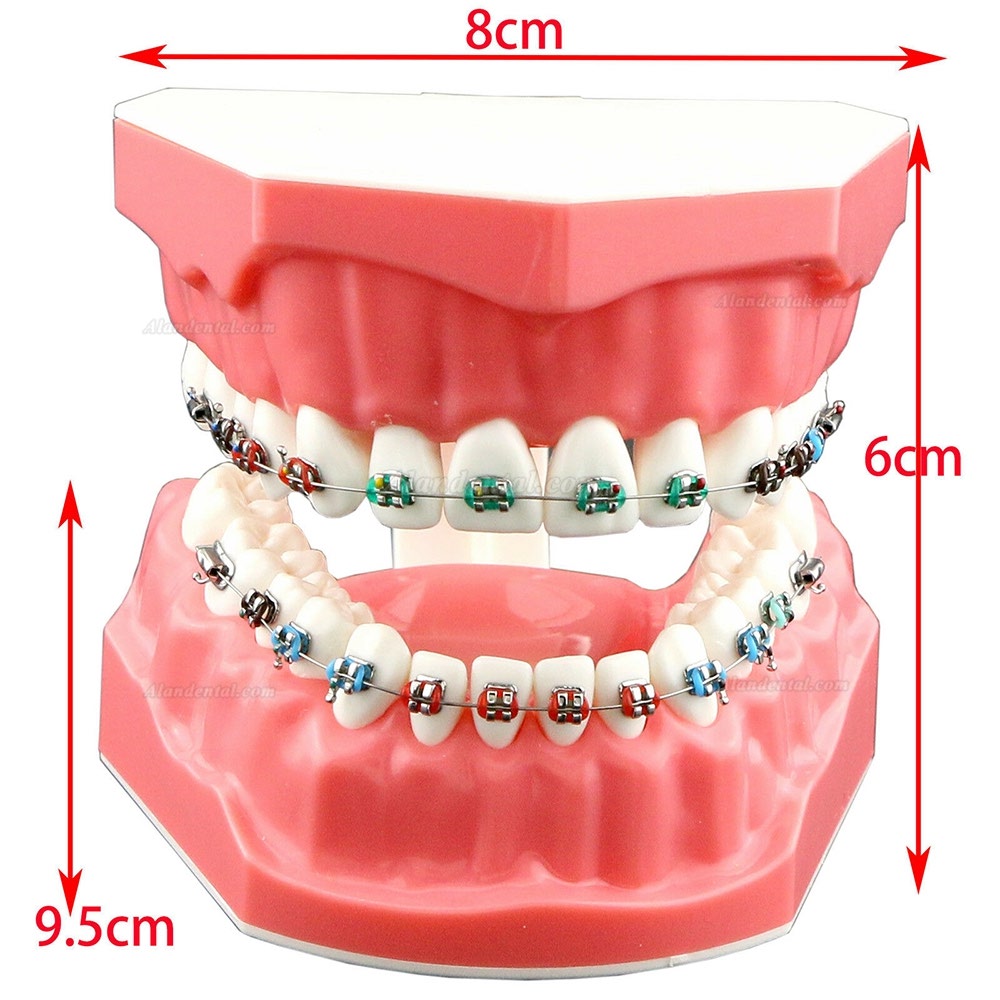 Dental Orthodontic Teeth Model + Metal Ceramic Bracket Tube Self-ligating Chain