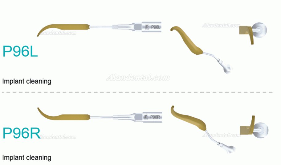 5Pcs Refine® Dental Implant Cleaning Tips P90 P94 P95 P96L P96R Fit For REFINE EMS MECTRON Woodpeaker