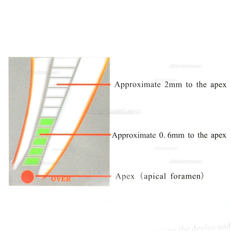 RebomEndo RPEX 6 4.5 LCD Dental Endodontic Root Canal RPEX Apex Locator
