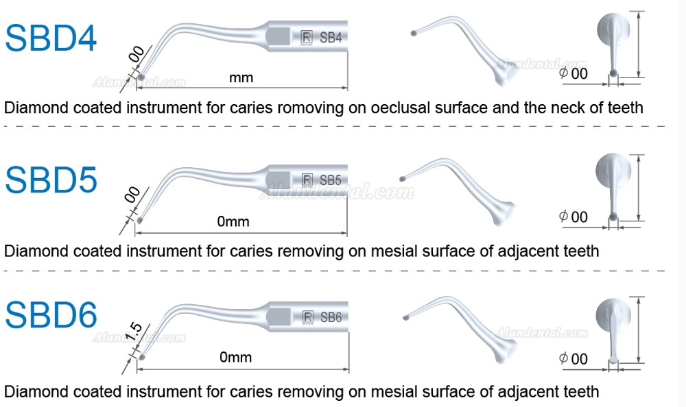 5Pcs Refine® Ultrasonic Caries Removing Tips SBD1 SBD2 SBD3 SBD4 SBD5/6 SBDR SBDL SBD7L SBD7R Compatible SATELEC NSK DTE GNATUS