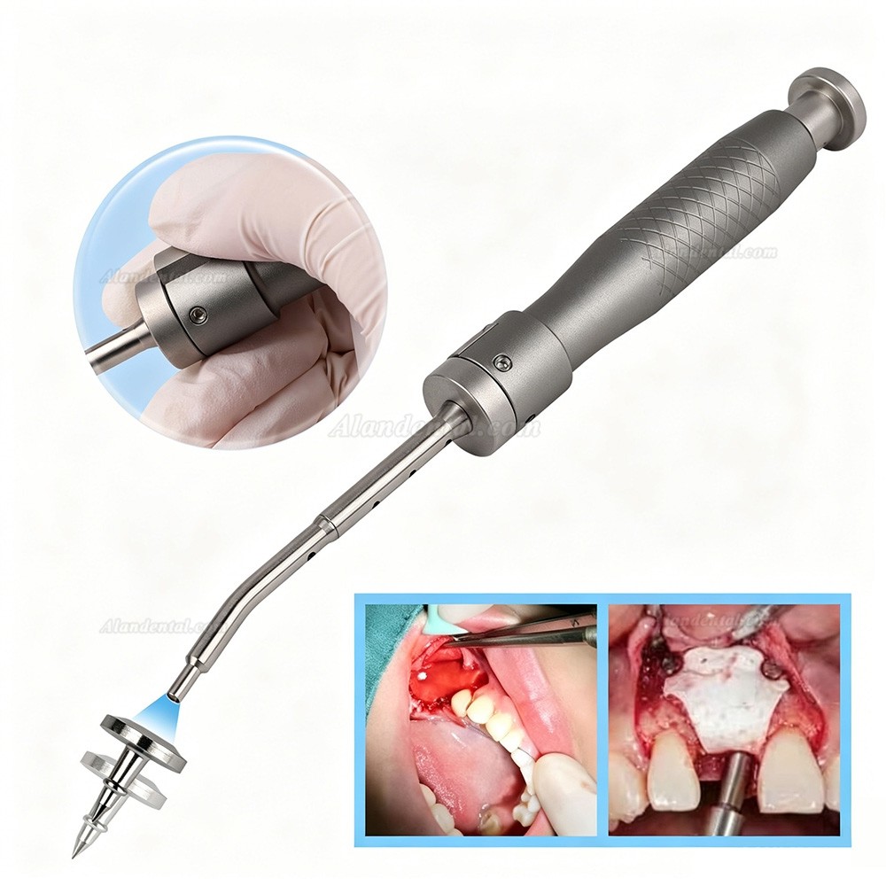 Buy Cheap SEGMA Automatic Mini Bone Tack Kit 30 Tacs 3mm / 4mm for FGG ...