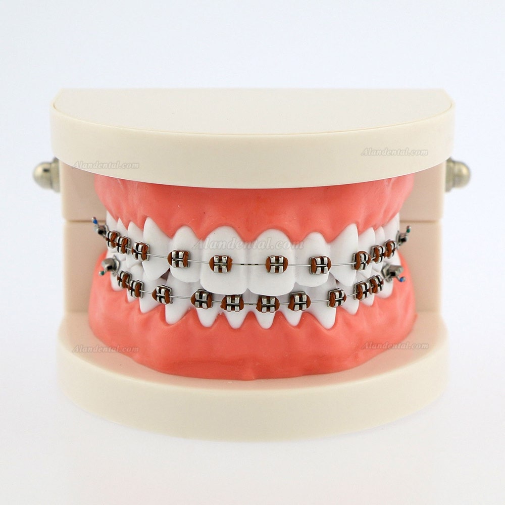 Dental Teach Typodont Demonstration Teeth Model with braces For patient Study 5006