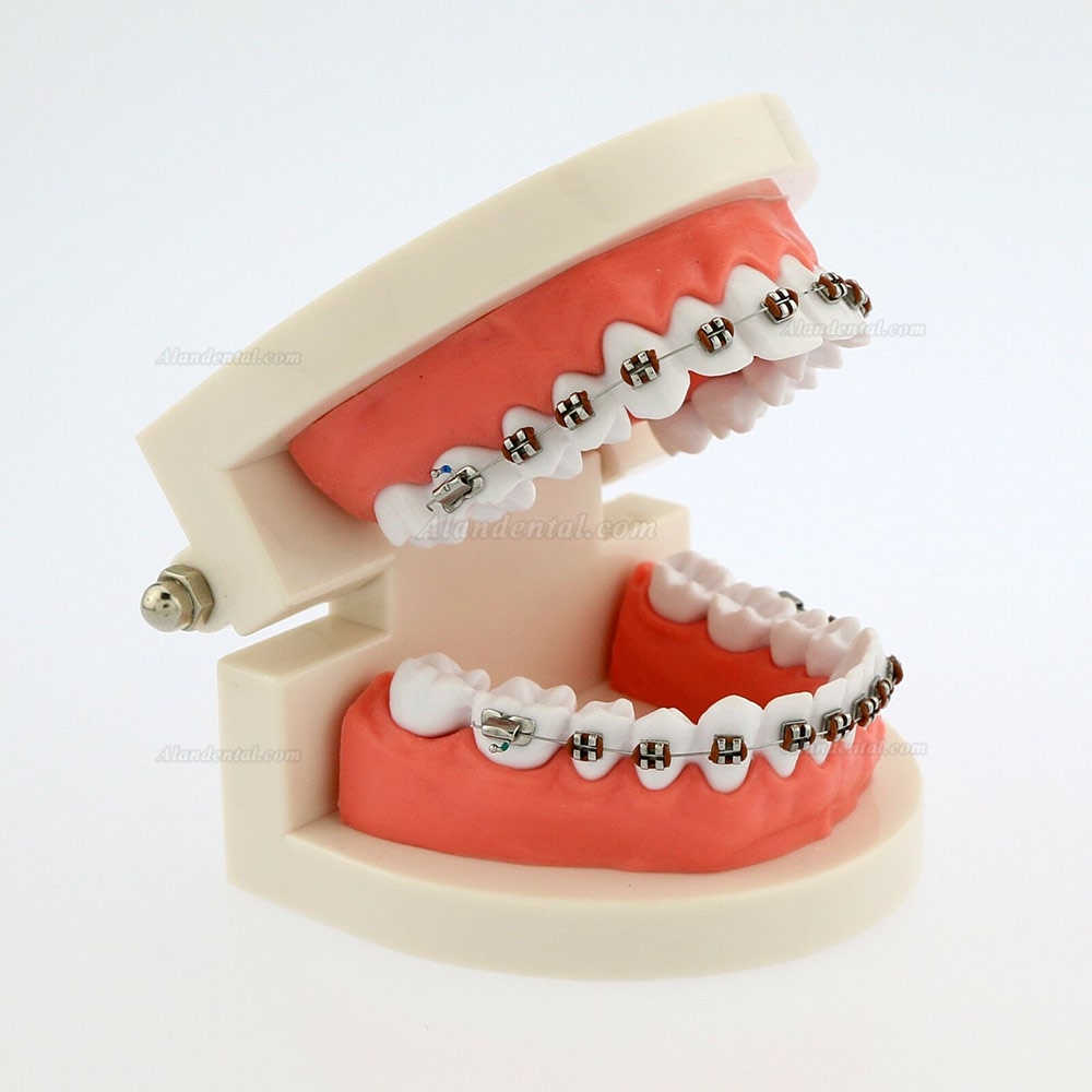 Dental Teach Typodont Demonstration Teeth Model with braces For patient Study 5006