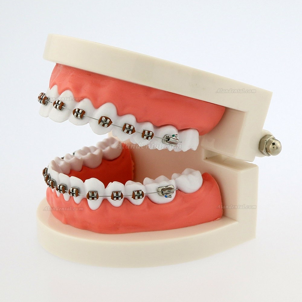 Dental Teach Typodont Demonstration Teeth Model with braces For patient Study 5006