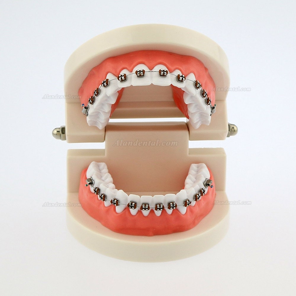 Dental Teach Typodont Demonstration Teeth Model with braces For patient Study 5006