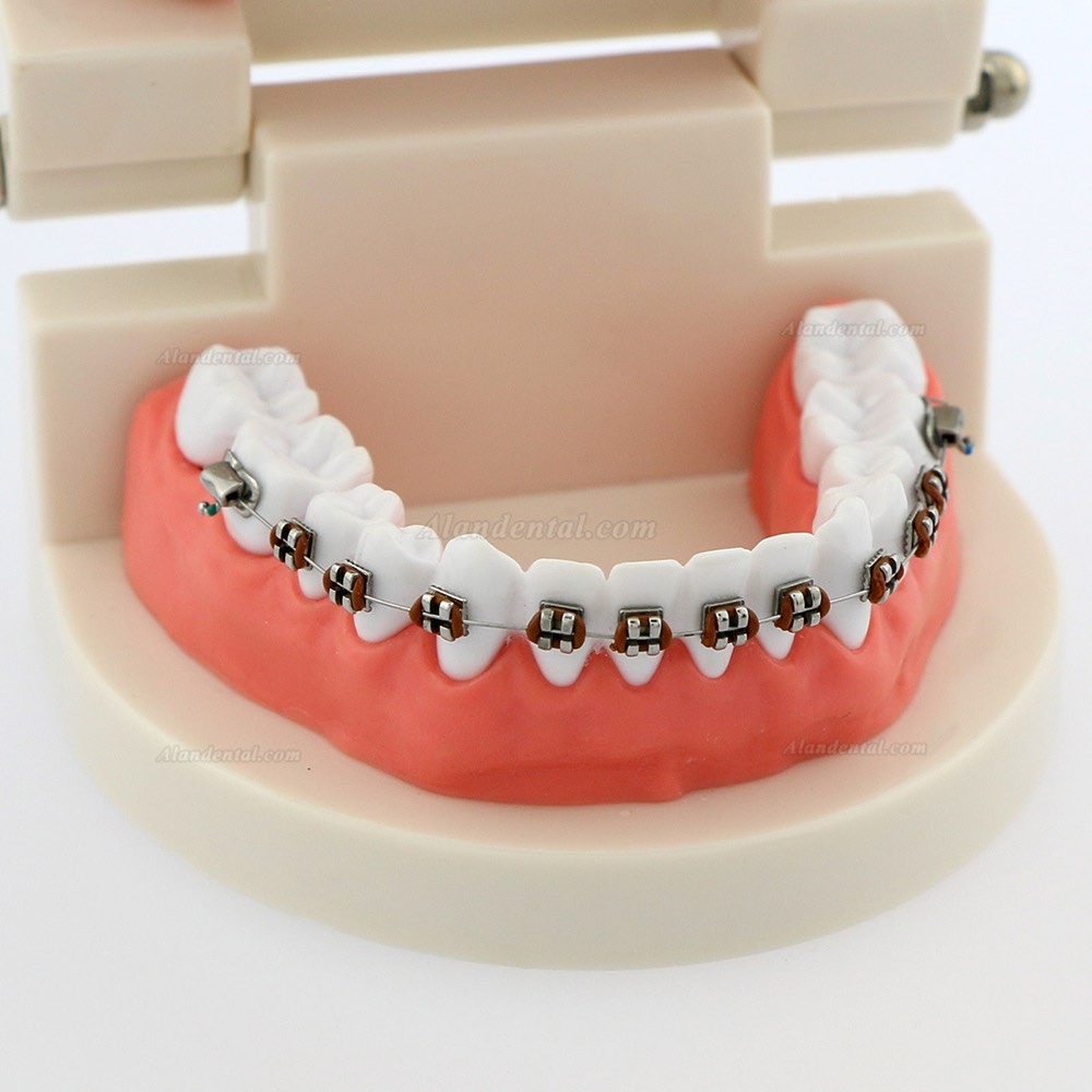 Dental Teach Typodont Demonstration Teeth Model with braces For patient Study 5006