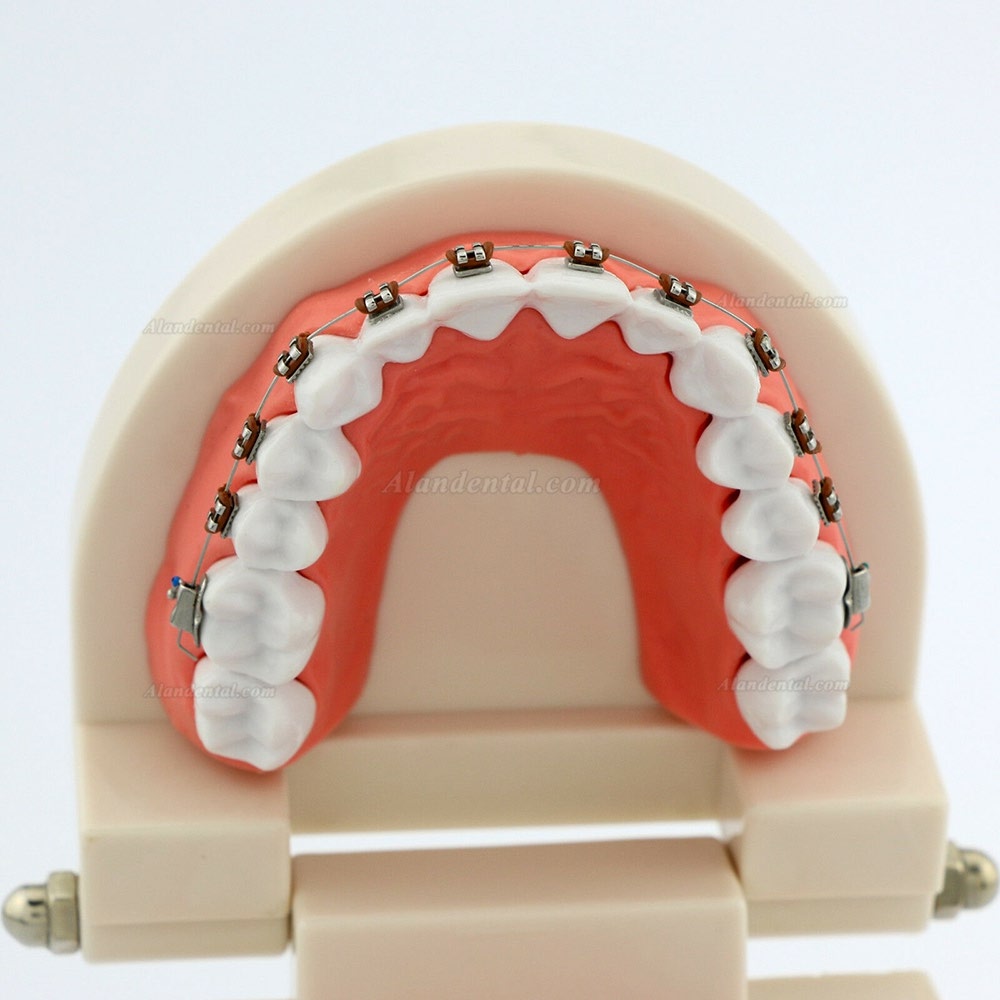 Dental Teach Typodont Demonstration Teeth Model with braces For patient Study 5006