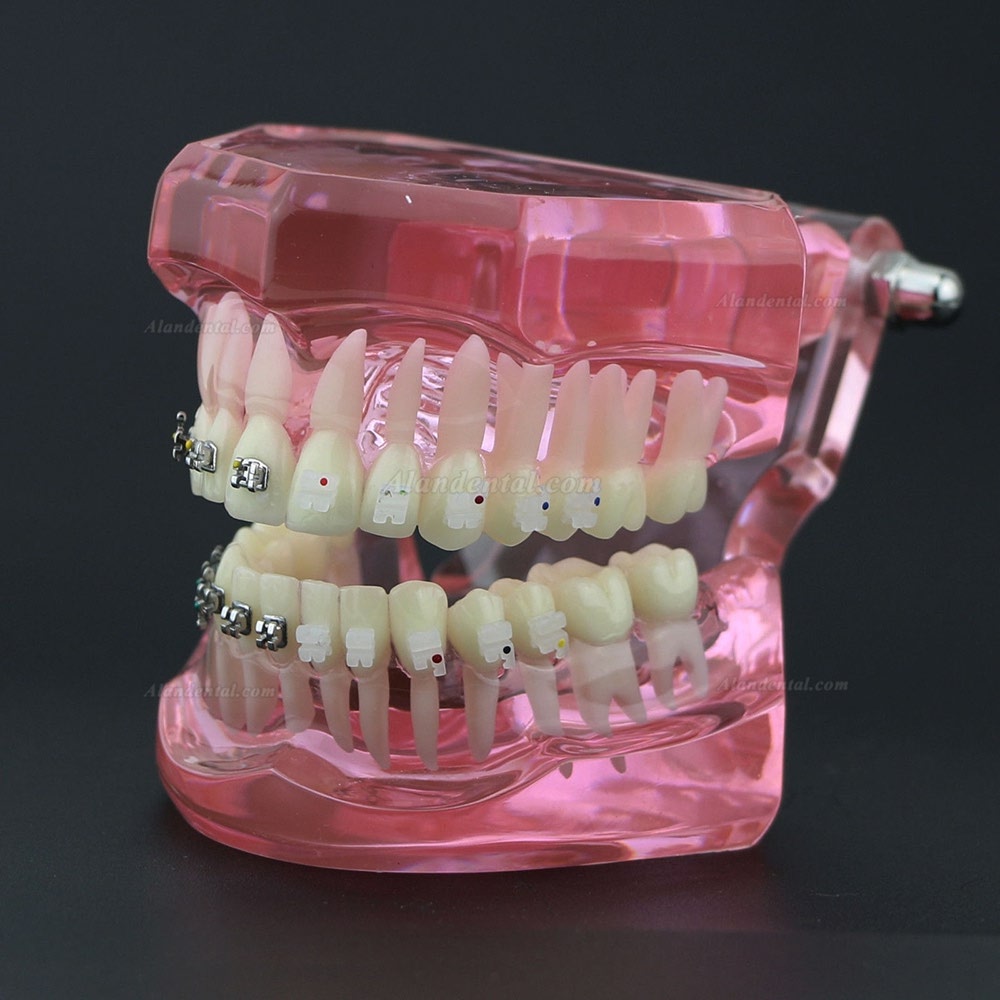 Dental Teeth Study Model Orthodontic With Metal and Ceramic Brackets 3003 Clear