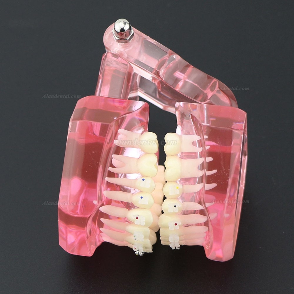 Dental Teeth Study Model Orthodontic With Metal and Ceramic Brackets 3003 Clear