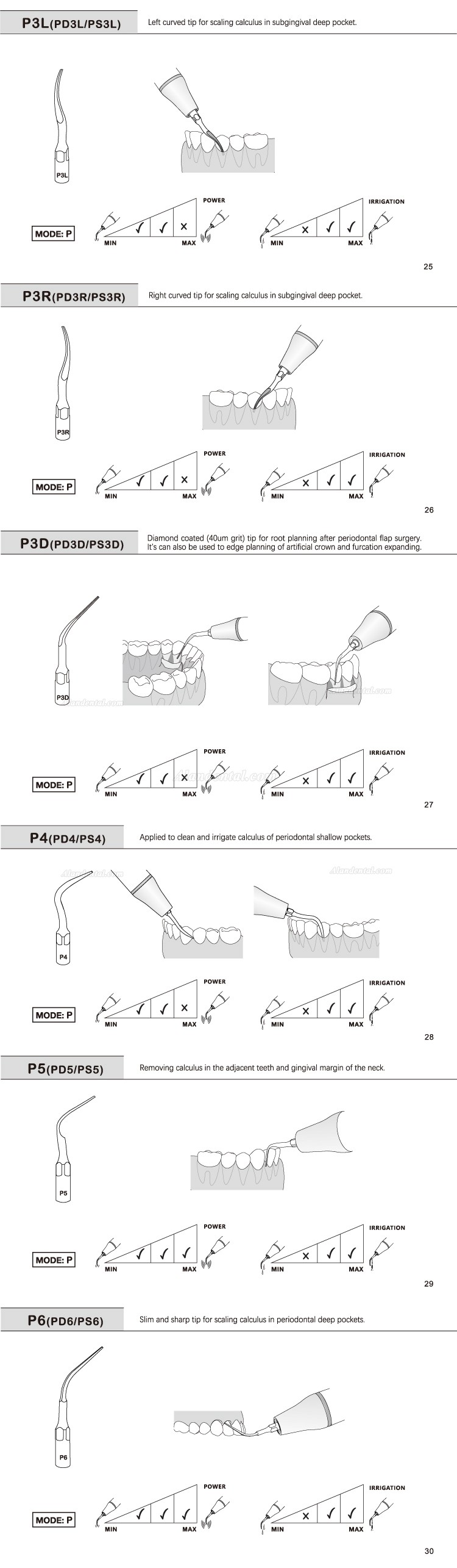 5Pcs Refine® Dental Ultrasonic Tips P2L P2R P2LD P2RD P5 P6 P7 P8 P10 P11 P12 P14L Fit For EMS Woodpecker Scaler Handpiece