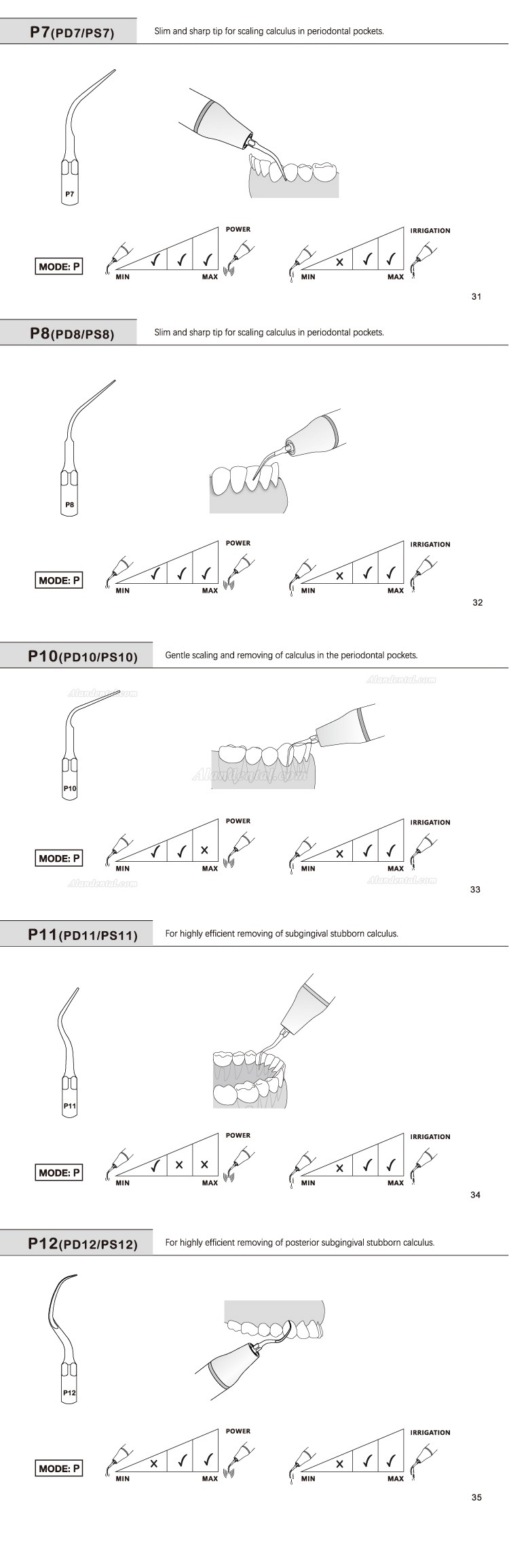 5Pcs Refine® Dental Ultrasonic Tips P2L P2R P2LD P2RD P5 P6 P7 P8 P10 P11 P12 P14L Fit For EMS Woodpecker Scaler Handpiece