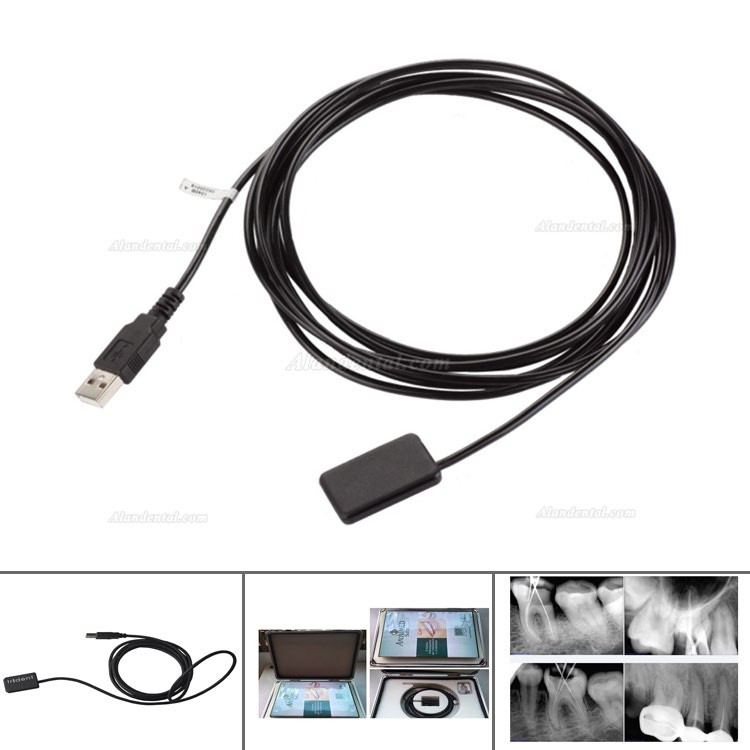 Buy Cheap Best Dental Digital Sensor Trident X Ray Imaging Diagnostic