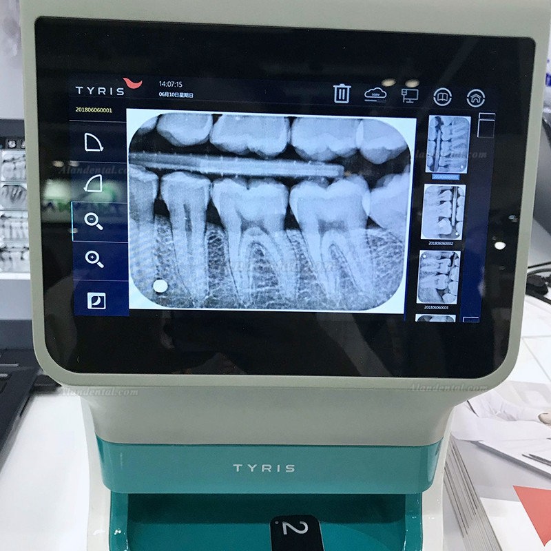 TYRIS TR-200 Dental Image Plate Scanner PSP X ray Scanner with True-color Touch Screen