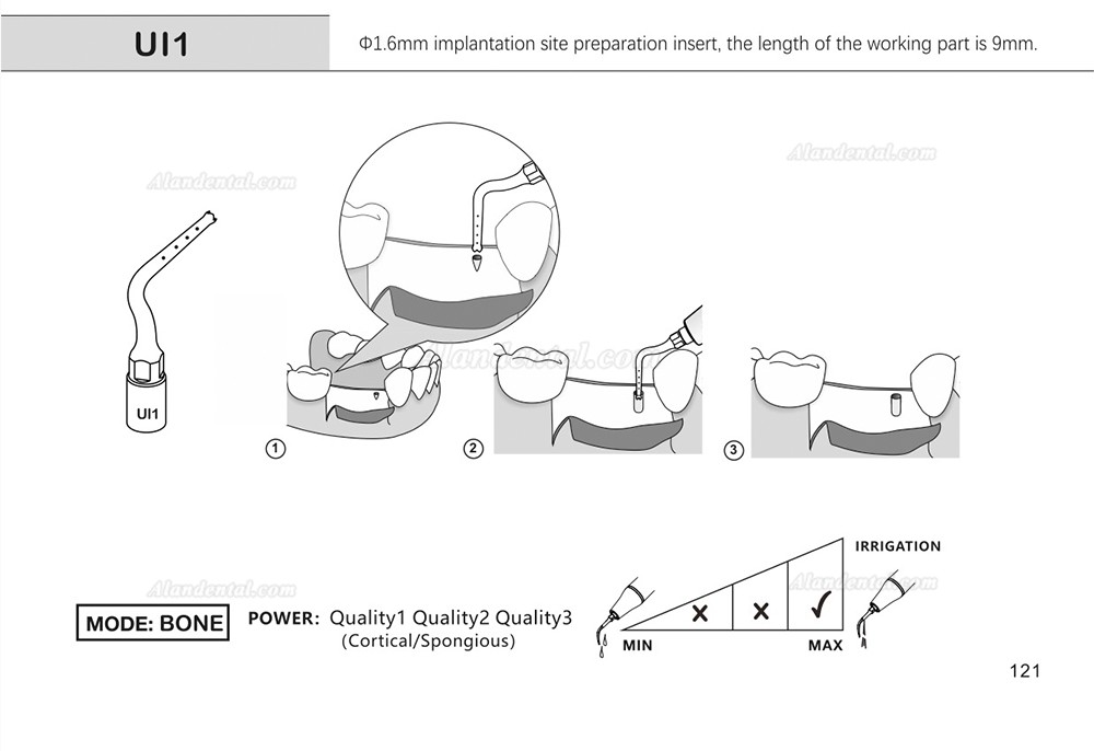 1Pcs Dental Piezosurgery Tips For Bone Cutting Sinus lifting Implant Ul1 UI2 UI3 UI4 UI5 Dental Surgery Tip Fit Mectron Woodpecker