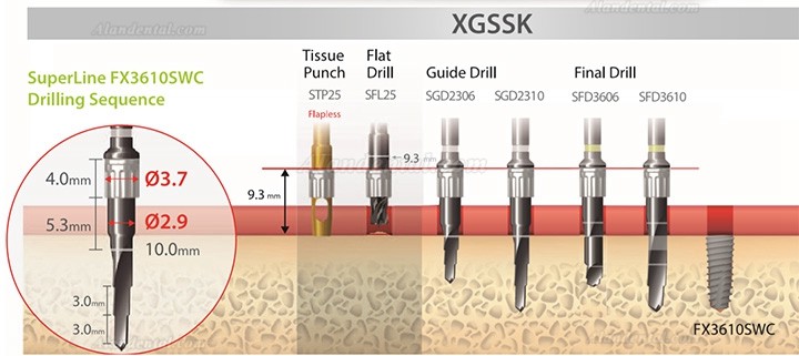 Dentium XGSSK Digital Guide Surgery Kit (Simple Kit) Dental Implant Instrument Kit