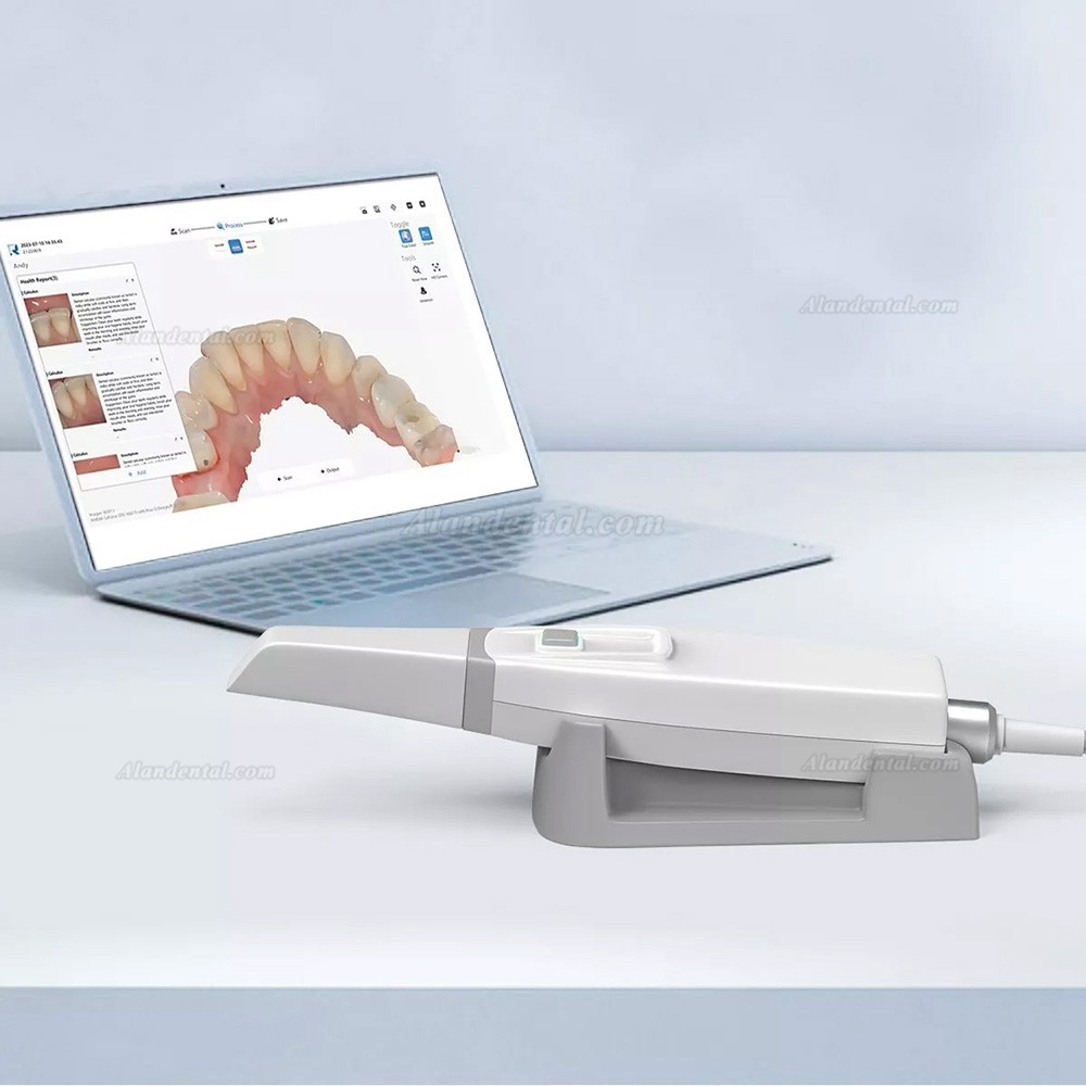 Buy Cheap YP-11 Dental Real Color 3D Intraoral Scanner Dental 3D ...