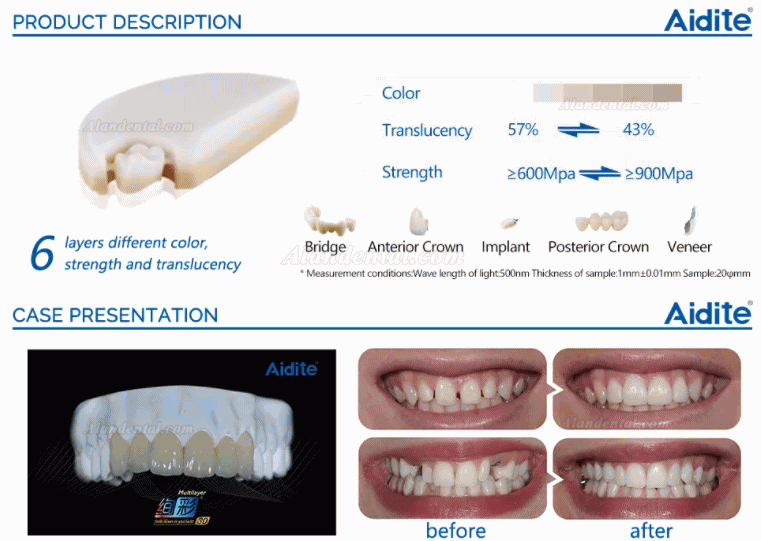 Aidite® 95/98mm A1-D4 Dental Multilayer PreShade Zirconia Blocks Denture Material For Aesthetic Restoration