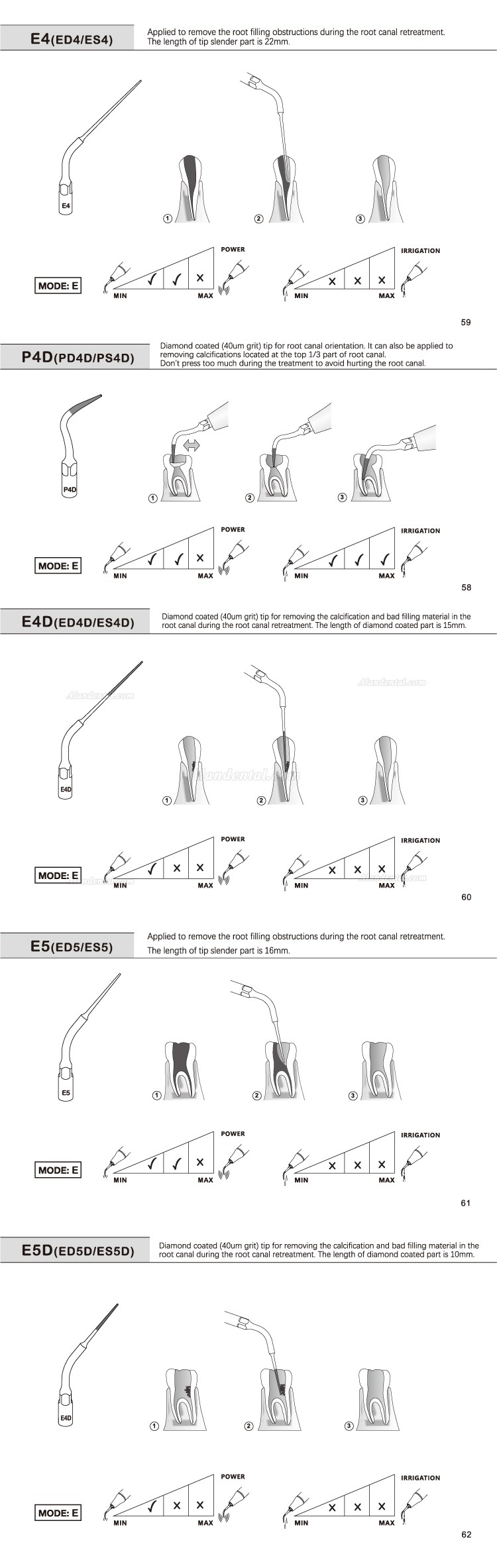 5Pcs Refine® Dental Root Canal Tips E1 E2 E3 E4 E4 E6 E7 E8 E9 E10 E11 E14 E15 Compatible EMS MECTRON WOODPECKER