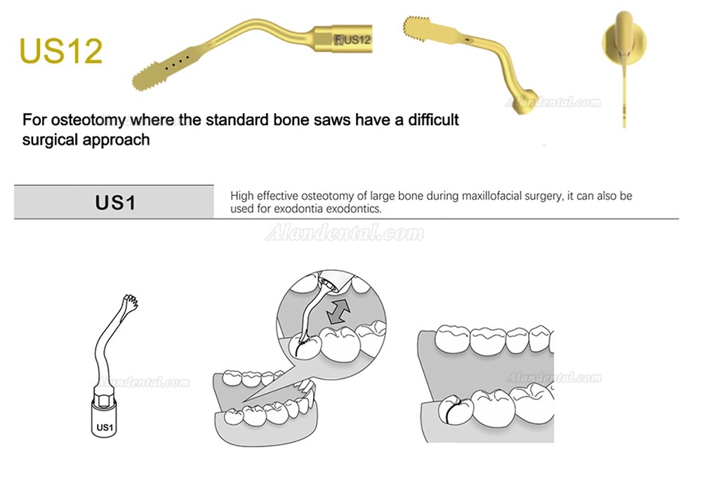 1Pcs Piezosurgery Osteotomy Bone Cutting Dental Surgery Tips US1 US1L US1R US2 US3 US4 US5 US6 US7 US11 US12 Fit Mectron